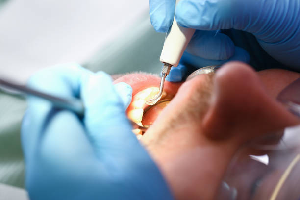 Best Emergency Gum Treatment in Arlington, TX
